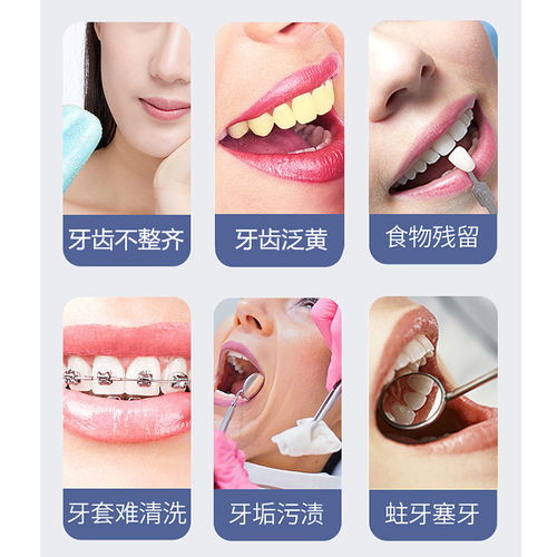 博皓便携式智能洗牙器 开启高效、便捷的口腔清洁新体验