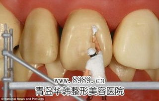 超声波洗牙与牙膏的功效对比分析